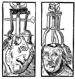 Engraving by Peter Treveris of a trepanation. From Heironymus von Braunschweig's Handywarke of surgeri